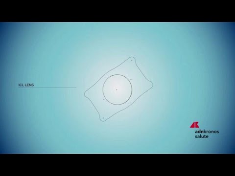Salute: nuove possibilità nella correzione dei difetti visivi con le lenti Icl