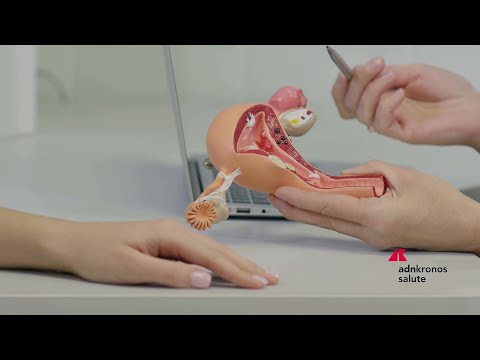 Vaccini: Blocca l’Hpv, contro cancro da Papillomavirus nuova campagna Msd e Serie A Women
